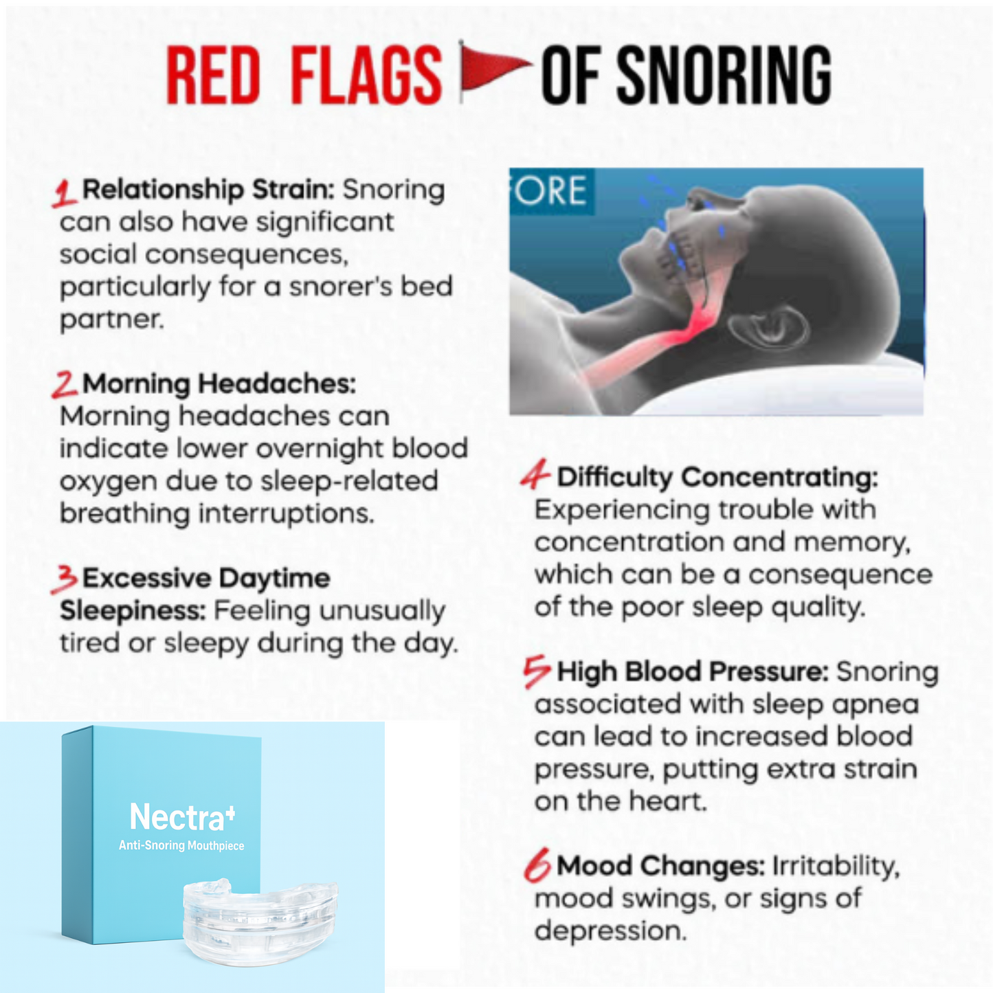 Nectra Anti-Snoring Mouthpiece